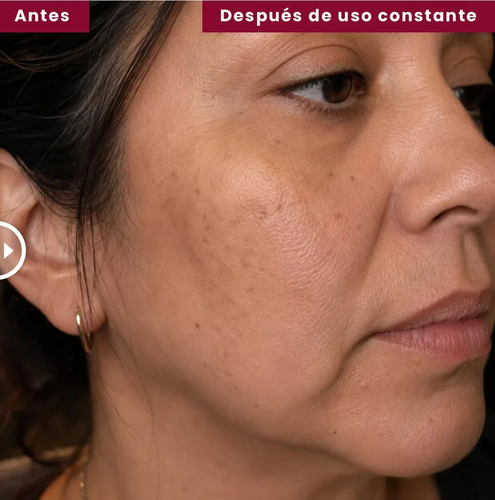 Antes y después de uso constante