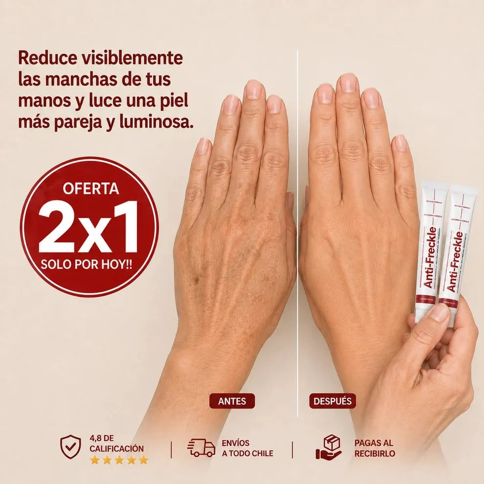 Antes y después, manos con manchas reducidas
